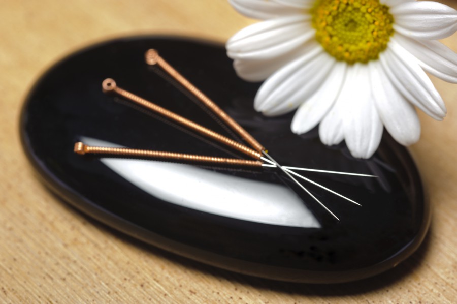 Acupuncture